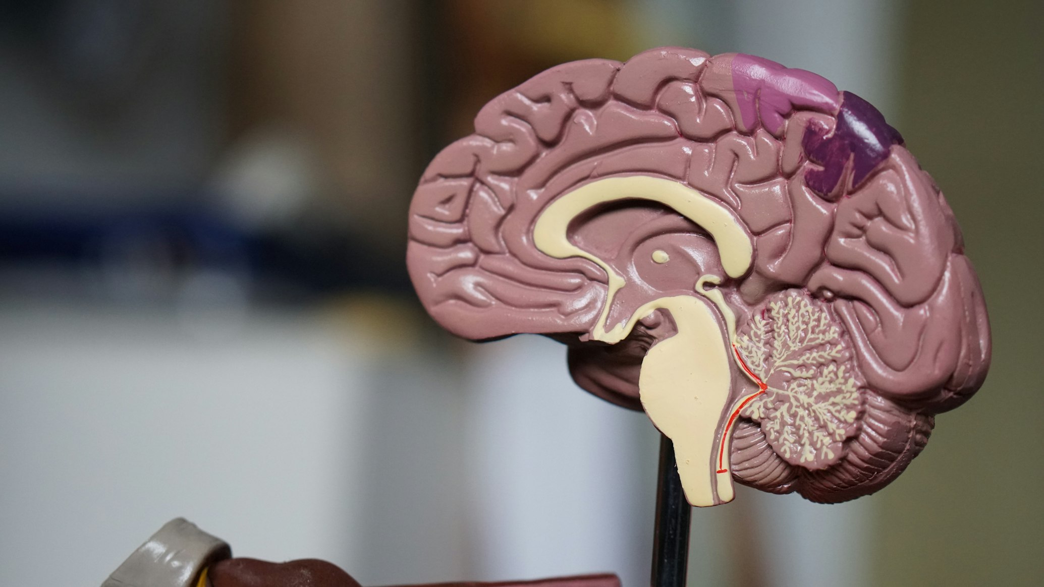Brain illustration showing neurotransmitters and the effects of exercise on mental health