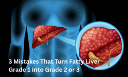 3 Mistakes That Turn Fatty Liver Grade 1 Into Grade 2 or 3