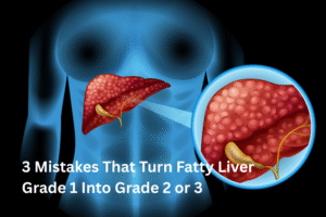 3 Mistakes That Turn Fatty Liver Grade 1 Into Grade 2 or 3